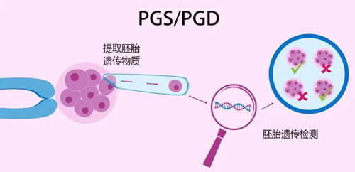 美国试管婴儿PGS/PGD全基因检测