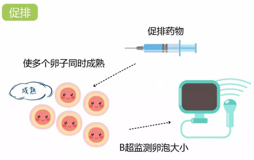 美国试管婴儿卵泡监测