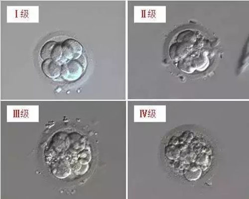 美国试管婴儿胚胎等级